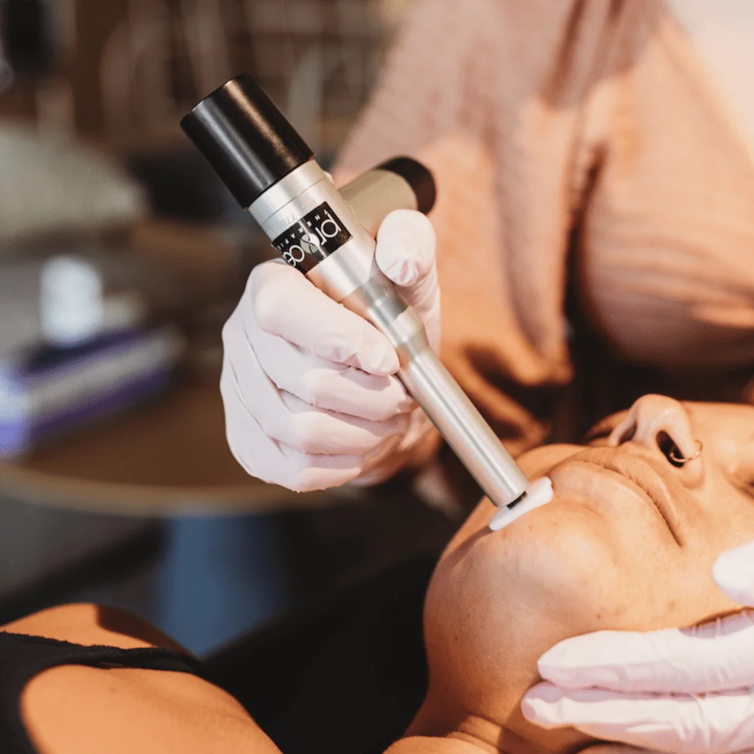 Microneedling