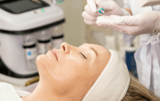 Post-Summer Skin Reset: How Chemical Peels Refresh Dull, Uneven Skin